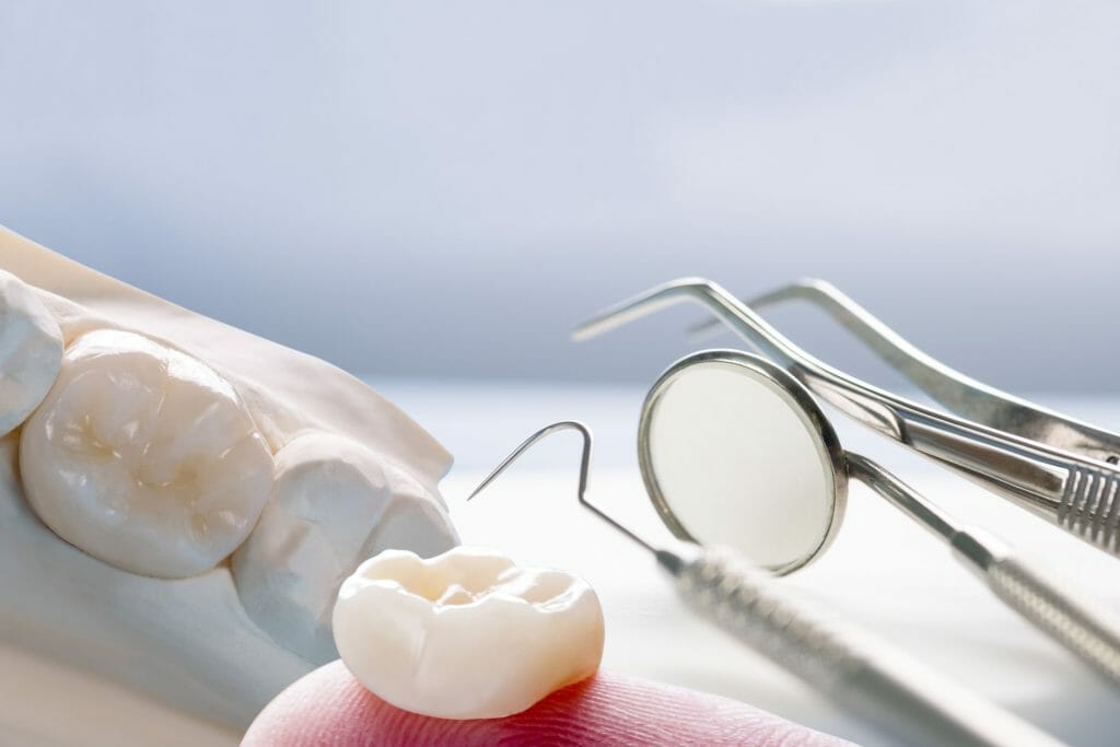 Purpose, Method, Risks, and Treatment of Dental Crowns